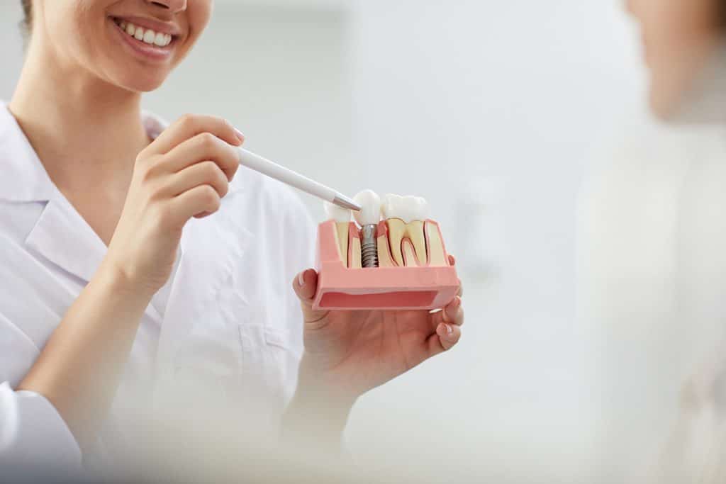 Benefits of Dental Implants